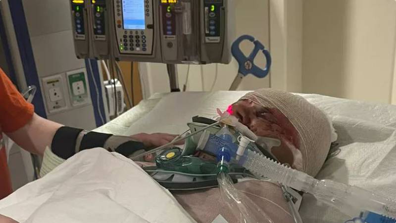 Kyleen Waltman was mauled by three dogs, two of which were pit bulls, outside a home on Ball...