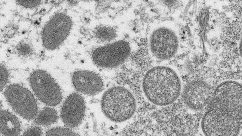 Monkeypox cells.