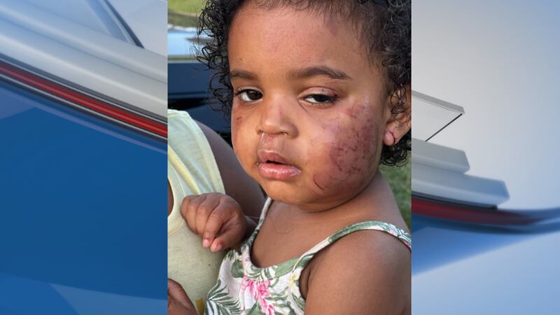 A 1-year-old was attacked inside an Albany daycare facility.