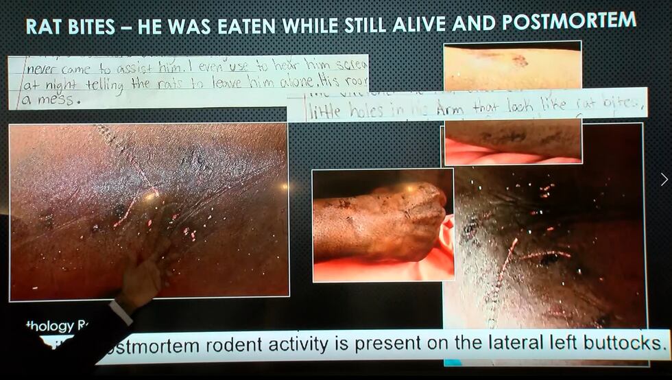 Images from the presentation show rat bites on Lason Butler's body.