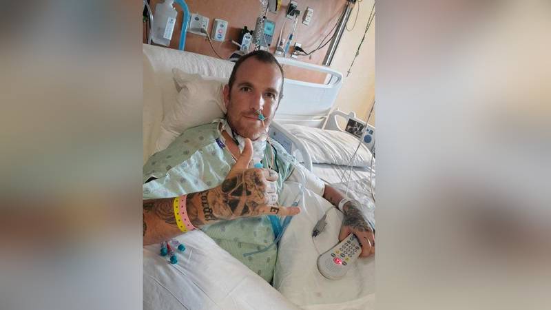 Jamie Calcasola spent 77 days in the hospital with COVID-19 while visiting his parents in North...